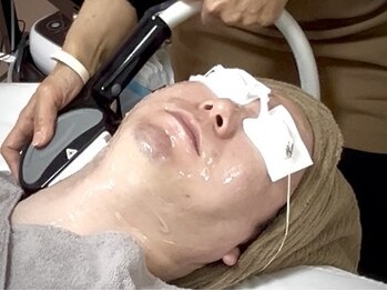 アロマ(AROMA)の写真/ヒゲ脱毛×肌荒れ改善！敏感肌・ニキビ肌もOK。清潔感UPと肌質改善が同時に叶う、メンズ美肌脱毛◎