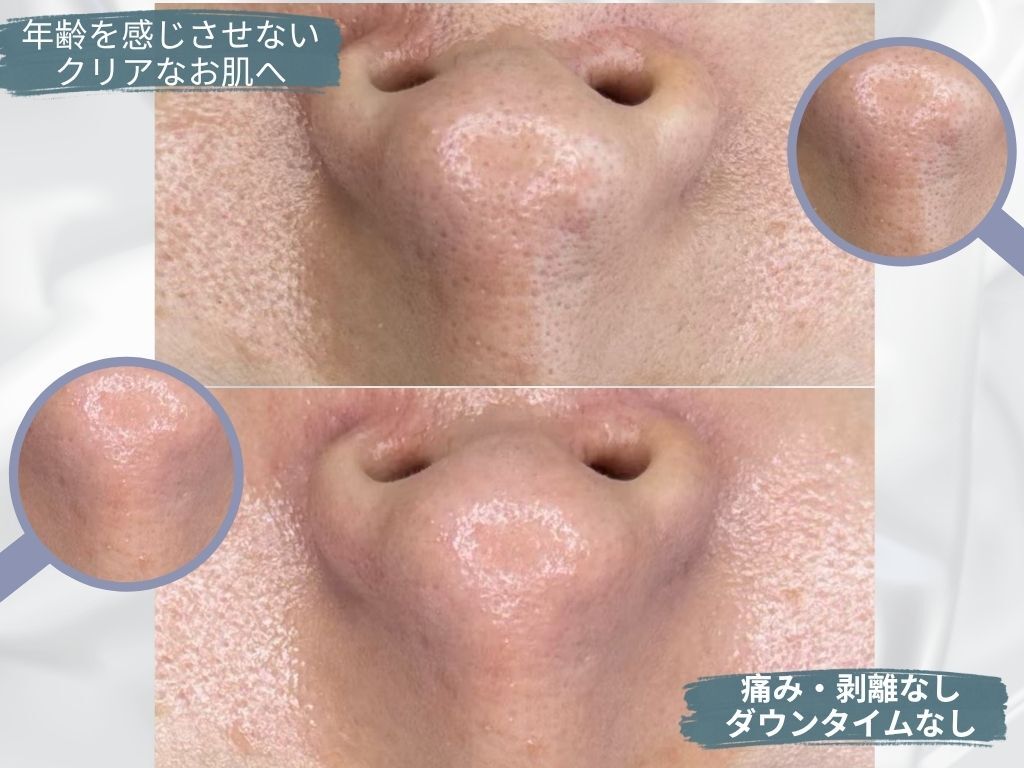 ビベル 八木店(Bebelle)｜ホットペッパービューティー