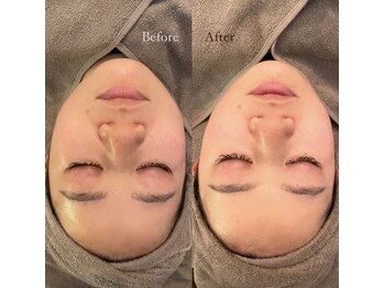 サラサ ビューティーサロン(SARASA)/フェイシャルエステの効果♪