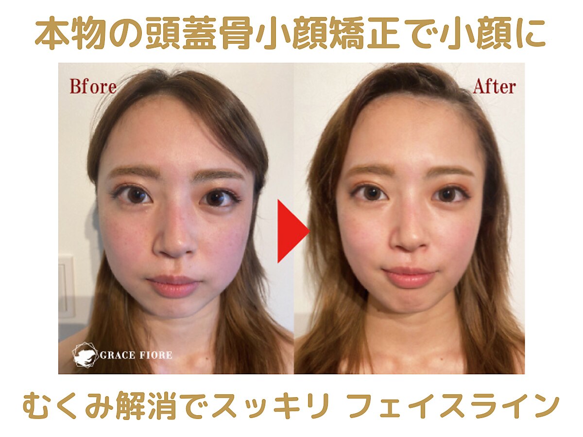 【はじめての人のための頭蓋骨矯正】 友達のオススメで頭蓋骨矯正に行って来た！！ 驚くくらい、身体
