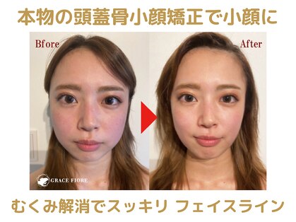 頭蓋骨 小顔矯正サロン グレースフィオーレ 札幌店(gracefiore)の写真