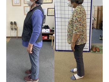 ニコ(niko)/姿勢改善例