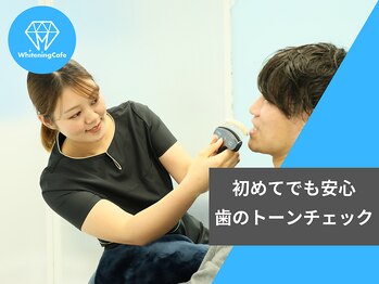 ホワイトニングカフェ 川越店/歯のホワイトニング トーン確認
