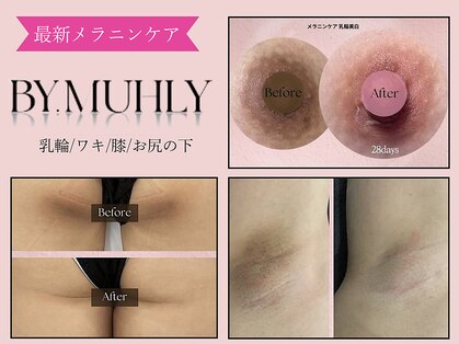 ダイア(DIA)の写真