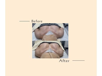 オベリオ(OBERIO)/