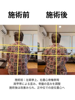 シトラスほぐし家整体院/施術
