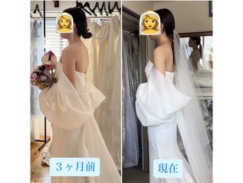 トータルボディケア サニー(TOTAL BODY CARE)/ブライダルエステbefore after