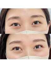 ダリア(DAHLIA)/［before⇒after］まつげパーマ