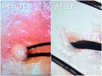 ベリルスパトリートメント(BERYL SPA TREATMENT)/余分な皮脂も除去！/ヘッドスパ