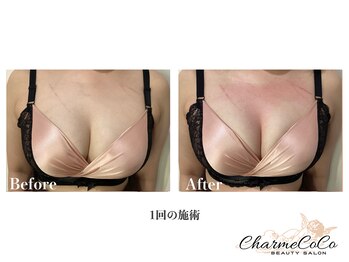 シャルムココ 蔵前店(CharmeCoCo)/お客様Before→After