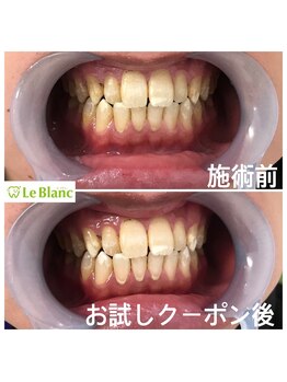 ルブラン 奈良店(Le Blanc)/気になるホワイトスポットも