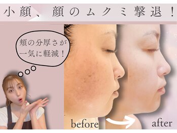 アメリオレ 三鷹店(AMELIORER)/WINBACK、温熱小顔造形☆