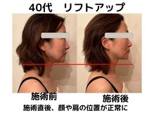 エンジェルエッグ/◆顔、肩の位置が元に戻る