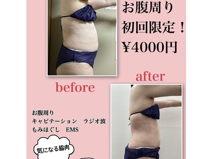 ブリリアント(Brilliant)の写真