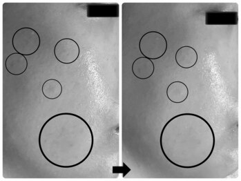 エフェクト 塚口店(effect)/Before After