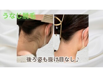 ヴィ シェーン(Vi Schoen)の写真/うなじ脱毛も◎あなたに寄り添う丁寧な接客で自信あふれる毎日に☆