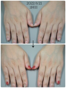 ネイル キャンバス シルヴァ(Nail Canvas Silva.)/