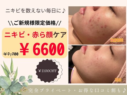 ガーベリー(GerbeLy)の写真