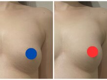 ポインセチア(Poinsettia)/ダイナミックバスト4DX/並び比較