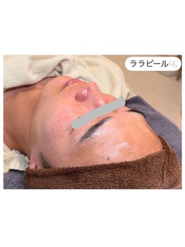 エ リンダ(E- LINDA)/ララピール