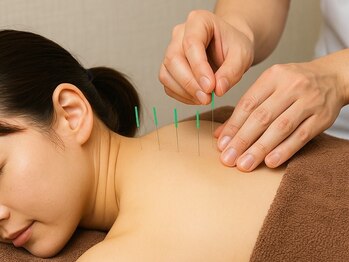 みずわき治療院の写真/忙しい方必見！《【クイック鍼灸施術】首肩凝り・頭痛・眼精疲労など¥1500(約15分)》サクッと疲労改善◎
