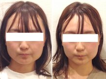 美容整体ウェリナ 中川八田院/小顔矯正/骨盤矯正/痩身整体