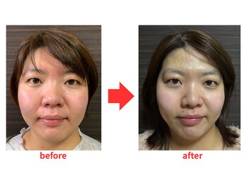 ブプラ 小倉店(BUPURA)/