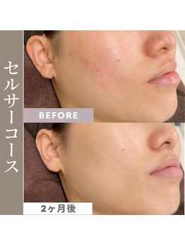 サードプレイス(3rd Place)/2階：エステ症例