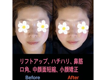 美容矯正サロン レレポノ(LELEPONO)/