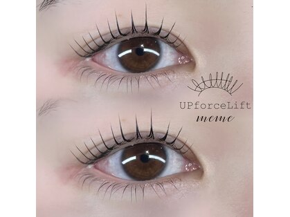 アップフォースリフト(UPforceLift)の写真