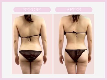 スリムライン 弘前店(The Slim Line)/before→after