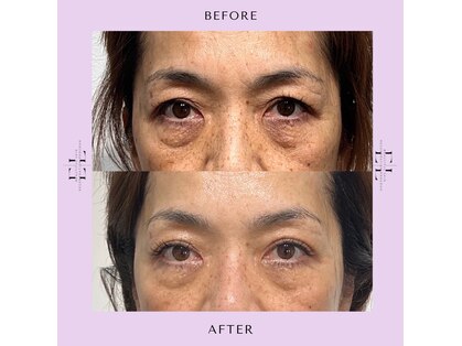 キー バイ マグラフ 南松本店店(KYE by Mag R.A.F)の写真