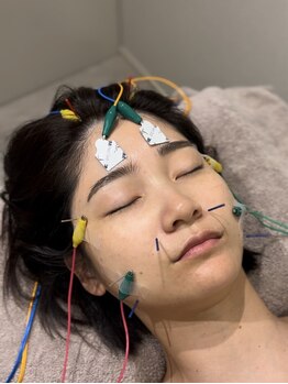 ミプラス鍼灸スタジオの写真/美容鍼×小顔矯正の相乗効果で理想の美顔へ☆お化粧したまま気軽に本格美肌ケア♪首や頭へも徹底アプローチ