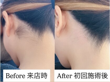 ミシル(Mishil)の写真