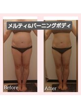 ヨリーズサロン(yoris.salon)/１回でこの結果デス
