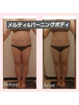 ヨリーズサロン(yoris.salon)/１回でこの結果デス