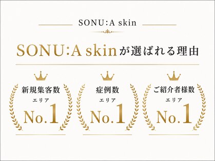 ソヌア(SONU:A)の写真