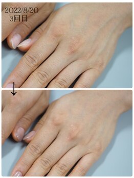 ネイル キャンバス シルヴァ(Nail Canvas Silva.)/