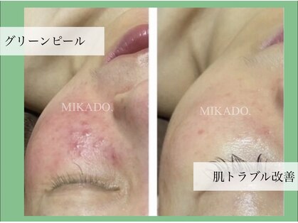 ミカド(MIKADO)の写真