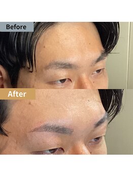 眉毛ハウス 吉祥寺店(眉毛HOUSE)/お客様の施術例(吉祥寺/東京)