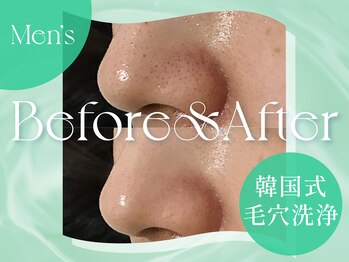 クリアラボ 上野(Clear Lab)/韓国肌管理&毛穴洗浄専門店