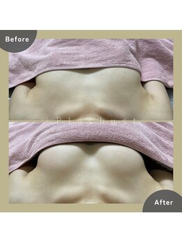 プラス バスト(+Plusバスト)/お客様BeforeAfterお写真