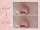 クリアラボ 川崎(Clear Lab)の写真/【韓国式肌管理】毛穴洗浄×ララピールで究極の肌管理★透明感溢れる水光&ツヤ肌でトーンアップが叶います