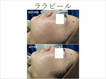 ティアム バイ テトテ 神戸三宮(TIAM by tetote)/ララピール