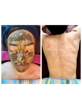 メンズフェイシャル