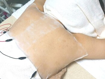 レゾン 京橋店/【ブライダルエステ】背中ケア