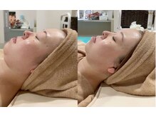 カブール 町田/高濃度バイオセルショット