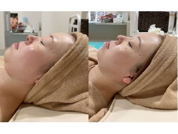 カブール 町田/高濃度バイオセルショット