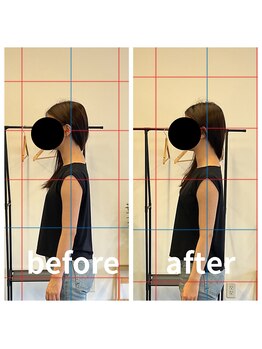 熊本カワル整体 JR上熊本駅院/ストレートネック