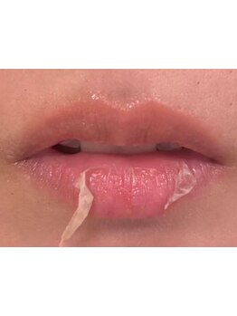 お肌をきれいにしたい